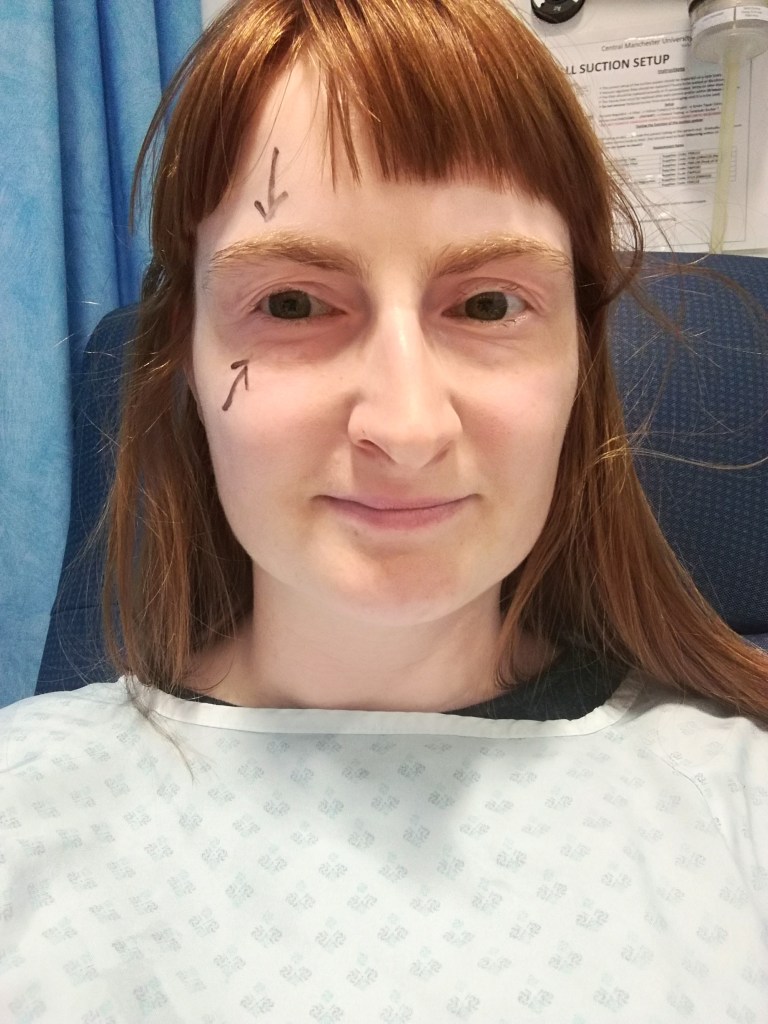 Image of a woman in hospital being prepped for eye surgery. #MummyMonday Day Patient at Manchester Royal Eye Hospital. Catherine Green being prepped for eye surgery image copyright SpookyMrsGreen.com mindful parenting and modern pagan lifestyle blog.