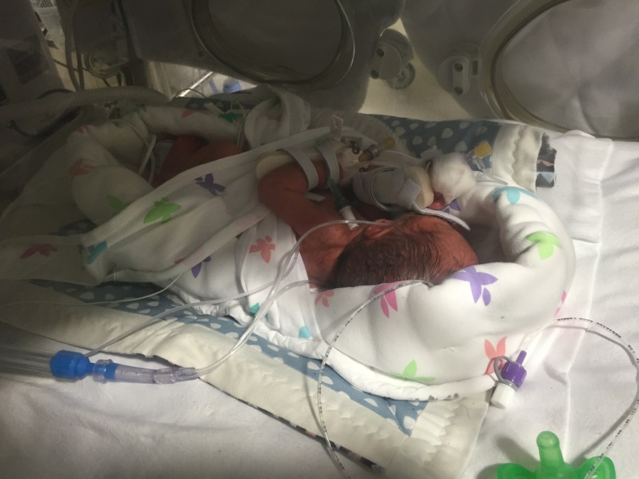 Photo of a tiny premature new-born baby in the hospital NICU. #PrematurityAwarenessMonth Image Credit @LotsofLotty for World Prematurity Day featured at SpookyMrsGreen.com mindful parenting and modern pagan lifestyle blog.