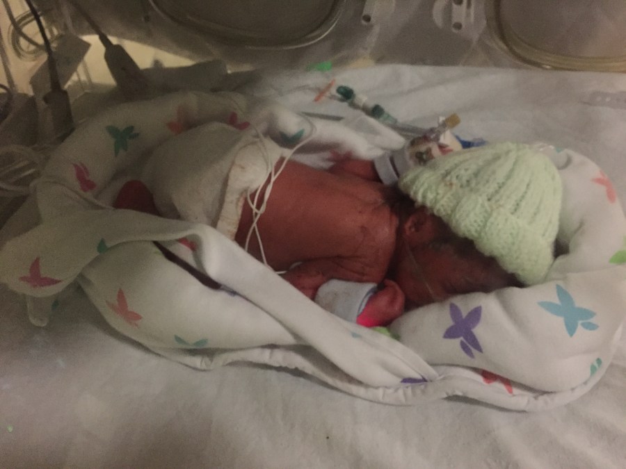 Photo of a tiny premature new-born baby in the hospital NICU. #PrematurityIs Image Credit @LotsofLotty for World Prematurity Day featured at SpookyMrsGreen.com mindful parenting and modern pagan lifestyle blog.