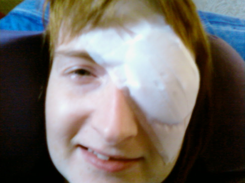 Patient recovering from eyelid rotation surgery at NHS hospital Manchester Royal Eye Infirmary. Copyright Catherine Green of SpookyMrsGreen.com mindful parenting and modern pagan lifestyle blog.