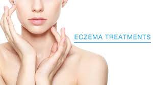 Eczema Treatments at Oxford Online Pharmacy affiliated with SpookyMrsGreen.com mindful parenting and modern pagan lifestyle blog.