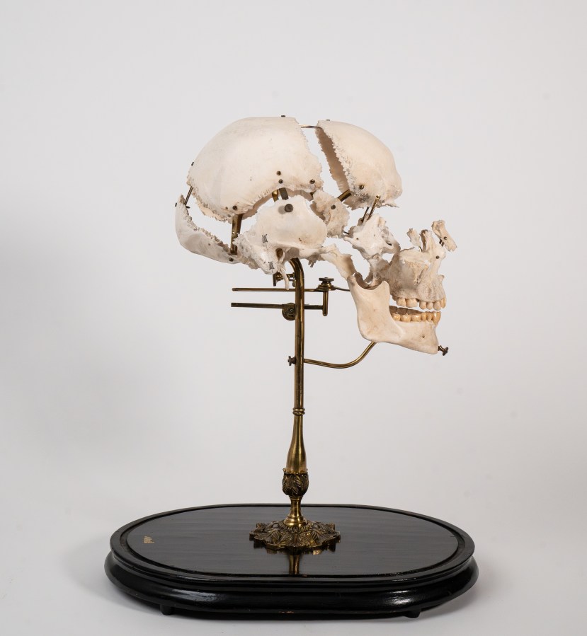 Tramond of Paris exploded skull on original base featured in “The Witch’s Door: Oddities & Tales from the Esoteric to the Extreme” by Ryan Matthew Cohn & Regina Rossi. Reviewed by paranormal author Catherine Green at SpookyMrsGreen.com.