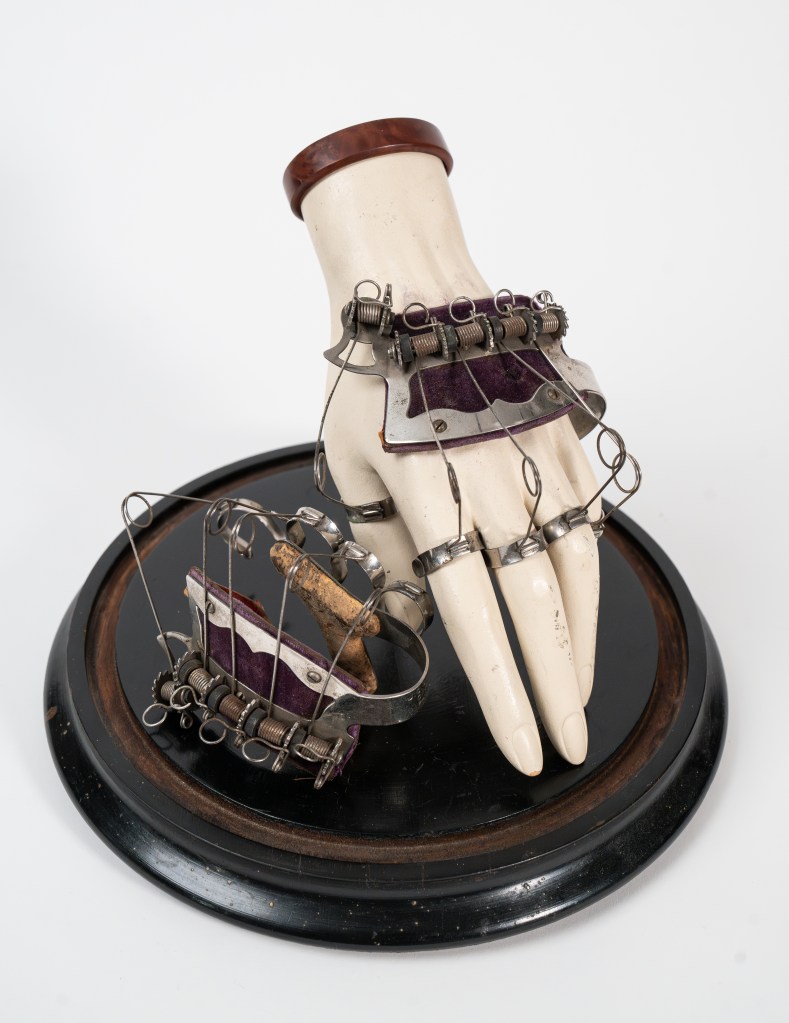 Victorian medical hand apparatus featured in “The Witch’s Door: Oddities & Tales from the Esoteric to the Extreme” by Ryan Matthew Cohn & Regina Rossi. Book reviewed by paranormal author Catherine Green at SpookyMrsGreen.com.